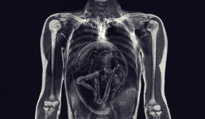 Alien: Covenant X-Ray Images Hint at Big Plot Detail!