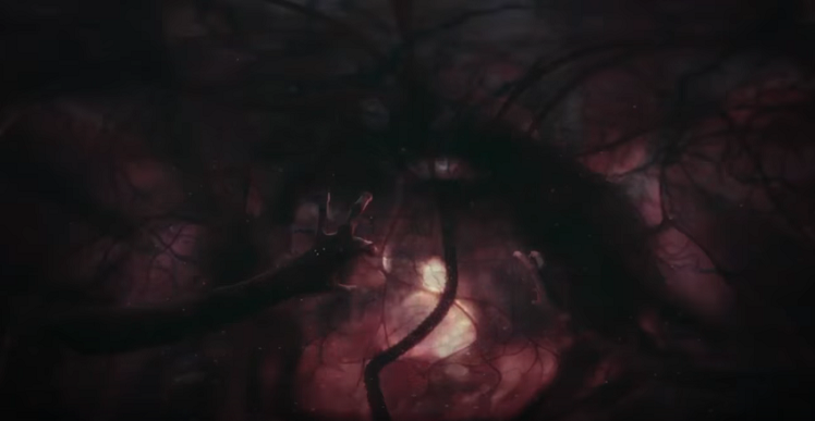 Neomorph Inside Womb, A Closer Look